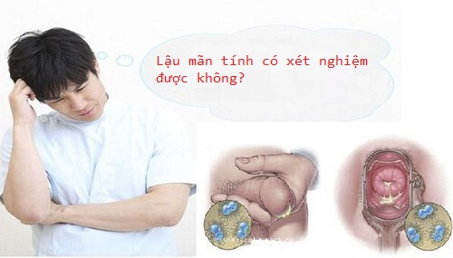 Lậu mãn tính có xét nghiệm được không?