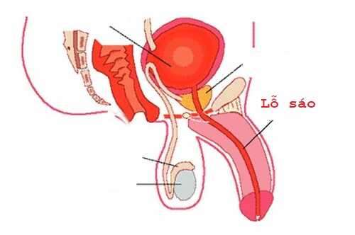 Hình ảnh lỗ sáo bình thường