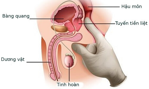 Tuyến tiền liệt