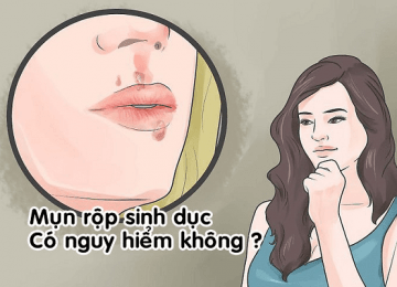 Bị mụn rộp sinh dục có nguy hiểm không ?
