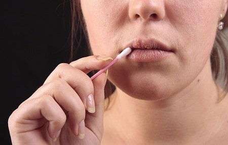 Cách phòng ngừa mụn rộp sinh dục môi