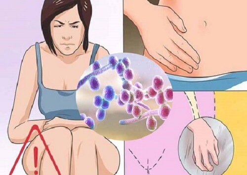 Nấm candida phát triển, gây bệnh ở bất cứ bộ phận nào trong cơ thể con người