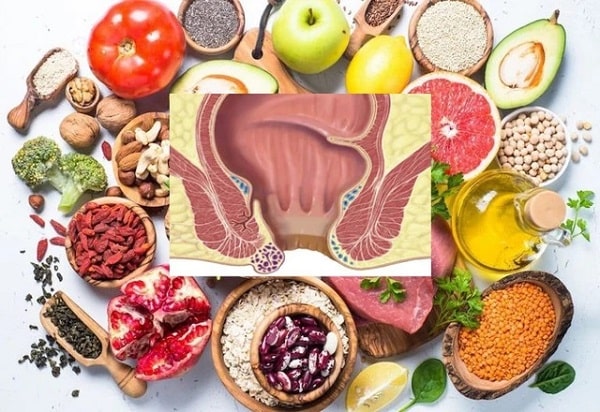 Chế độ ăn uống có mối liên quan chặt chẽ với bệnh trĩ nội