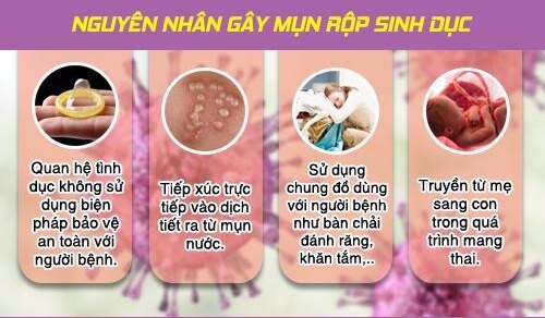 Nguyên nhân bị mụn rộp sinh dục