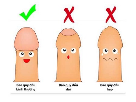 Những ai có nguy cơ bị hẹp bao quy đầu?