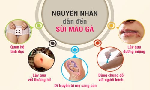 Nguyên nhân mắc bệnh sùi mào gà ở miệng