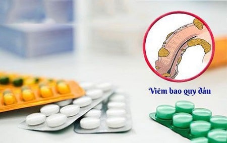 Thuốc chữa viêm bao quy đầu 