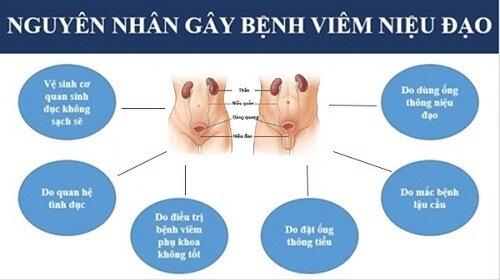 Nguyên nhân gây bệnh viêm niệu đạo