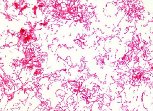 Nhiễm trực khuẩn gram âm