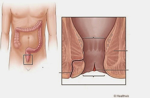 Biểu hiện bệnh nứt kẽ hậu môn