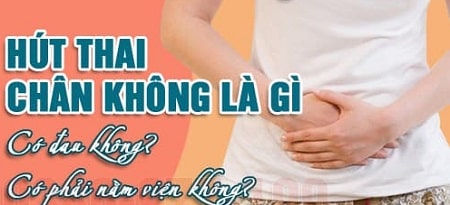 Định nghĩa và ưu điểm của phá thai hút chân không