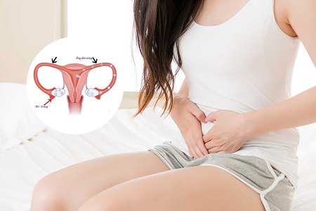 Tác hại của bệnh viêm ống dẫn trứng