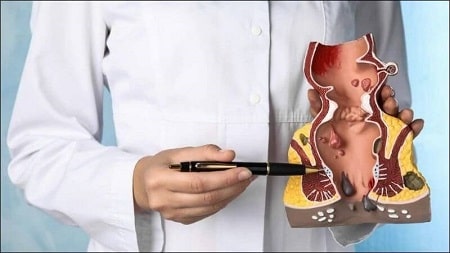 Trĩ nội và trĩ ngoại cái nào nặng hơn, nguy hiểm hơn ? 