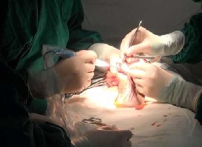 Phẫu thuật tăng kích thước cậu nhỏ