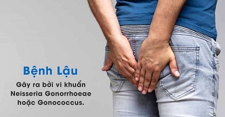 Tổng quan về bệnh lậu