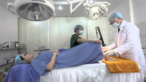 Phương pháp đốt viêm lộ tuyến truyền thống