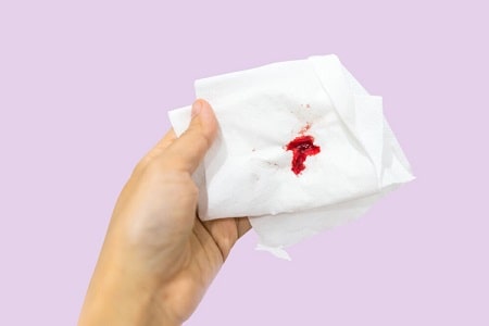 Khi quan hệ lần đầu ra máu nên làm gì?