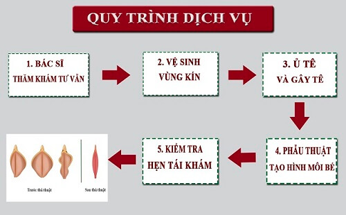 Quy trình cắt môi bé