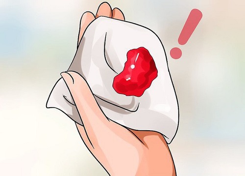 Ra máu bất thường ở vùng kín