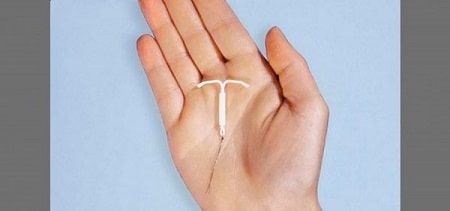 Rối loạn kinh nguyệt sau đặt vòng có nguy hiểm không?