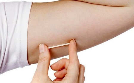 Tác dụng ngừa thai của que cấy tránh thai như thế nào ?