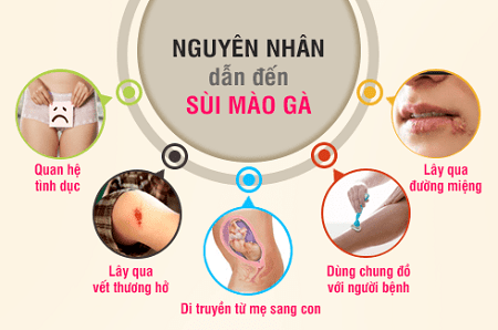 Các nguyên nhân gây bệnh sùi mào gà 