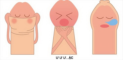 Sưng bao quy đầu sau khi quan hệ - Biểu hiện dài hẹp bao quy đầu