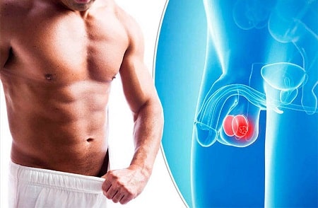 Phòng ngừa sưng tinh hoàn một bên tại nhà