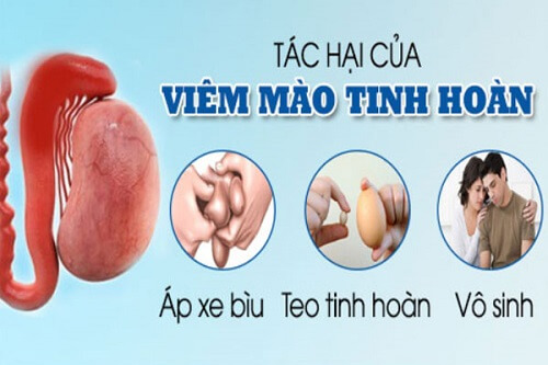Hậu quả của viêm mào tinh hoàn