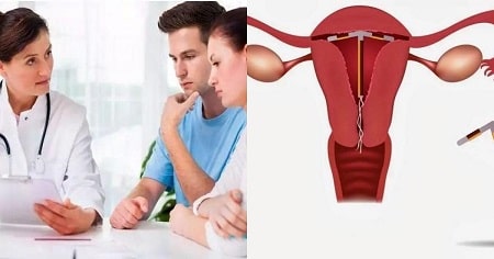 Tìm hiểu thêm những thắc mắc sau khi tháo vòng tránh thai