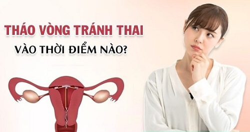 Tháo vòng tránh thai vào thời điểm nào thích hợp?