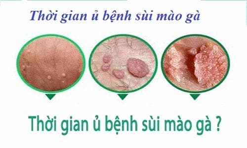 Thời gian ủ bệnh virus HPV trong bao lâu?