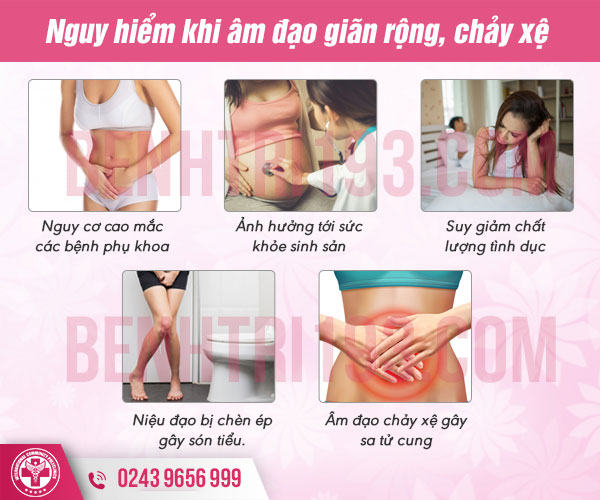 Vì sao cần thu nhỏ âm đạo sau sinh?