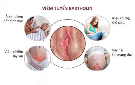 Lưu ý khi dùng thuốc chữa viêm tuyến Bartholin