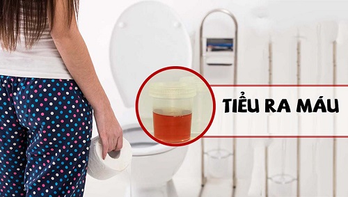 Viêm nhiễm phụ khoa bị ra máu