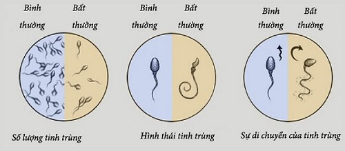 Tinh dịch bất thường