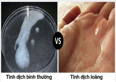 Làm sao để nhận biết tinh trùng của anh em đang khỏe mạnh ?