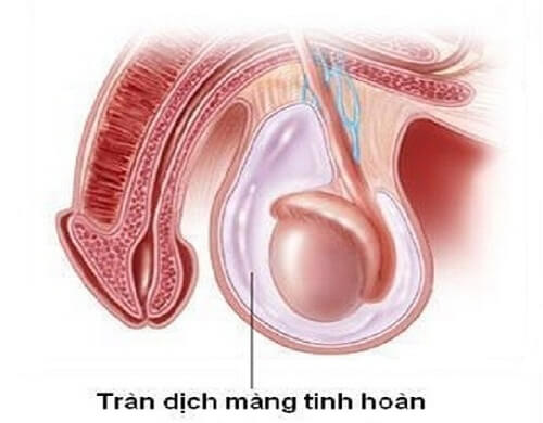 Dẫn lưu lượng dịch trong màng tinh hoàn