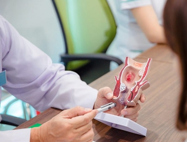 Những biến chứng nguy hiểm nếu không chữa trĩ nội độ 2