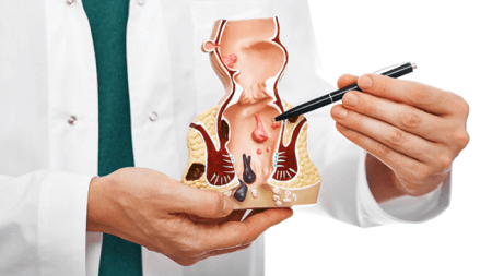 Triệu chứng bệnh trĩ ngoại nhẹ có tự khỏi được không ?