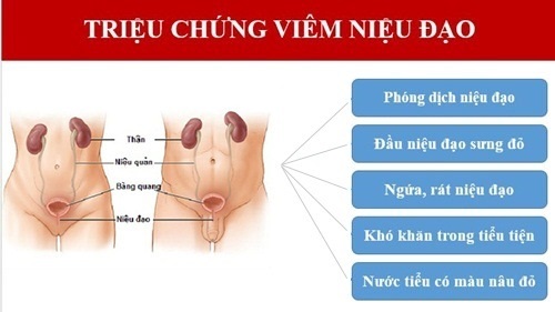 Triệu chứng bệnh viêm niệu đạo