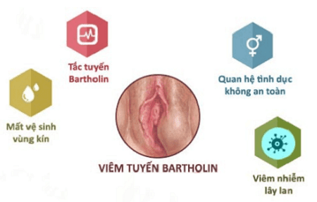 U tuyến Bartholin có nguy hiểm không?