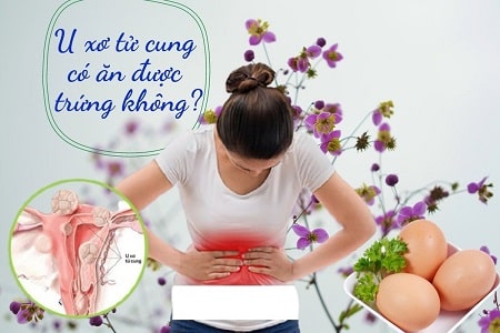 Chị em thắc mắc u xơ tử cung có được ăn trứng không?