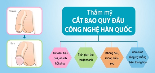Ưu điểm nổi bật của cắt bao quy đầu theo phương pháp Hàn Quốc