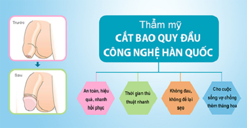 Ưu điểm phương pháp cắt bao quy đầu công nghệ Hàn Quốc