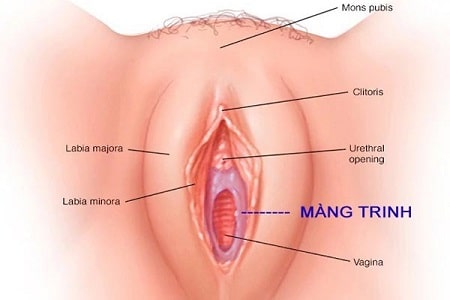 Vá màng trinh có ảnh hưởng gì không ?
