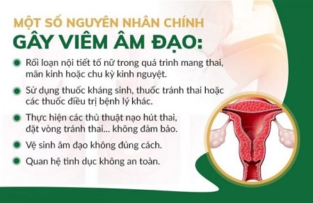 Nguyên nhân của viêm âm đạo không nên chủ quan