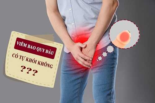 Viêm bao quy đầu có tự khỏi không?