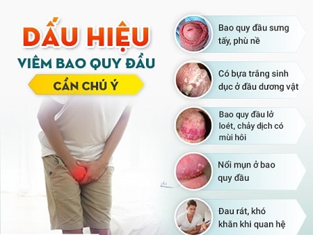 Nhận biết dấu hiệu viêm bao quy đầu mãn tính 