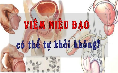 Viêm niệu đạo không thể tự khỏi khi không được phát hiện, điều trị kịp thời